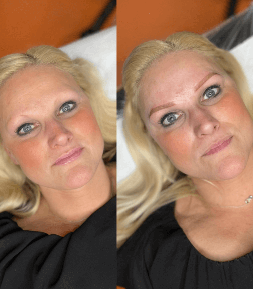 Before and After Eye Brow Perfection on Overpluck Eyebrows